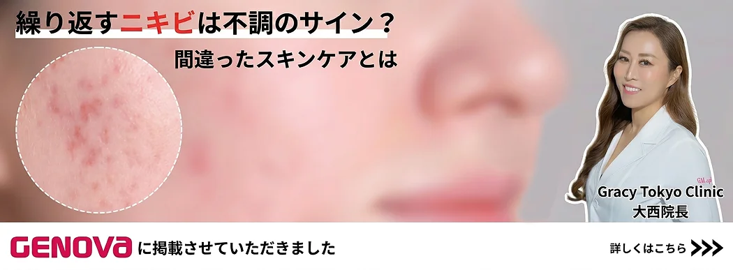 繰り返すニキビは不調のサイン？間違ったスキンケアとは